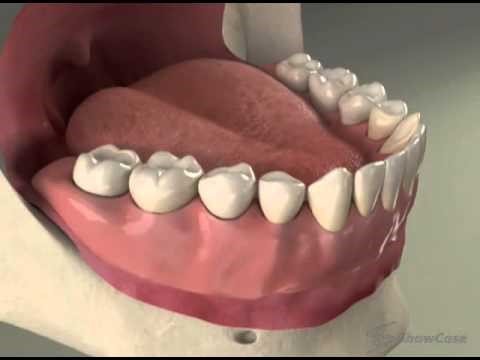 Balanced Occlusion In Complete Dentures Elsie MI 48831